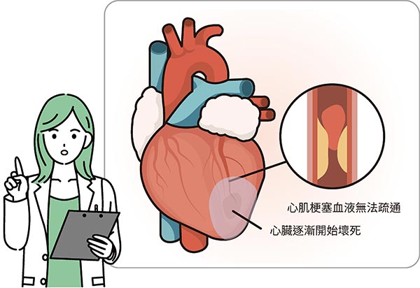 心肌梗塞血液無法疏通心臟逐漸開始壞死。
