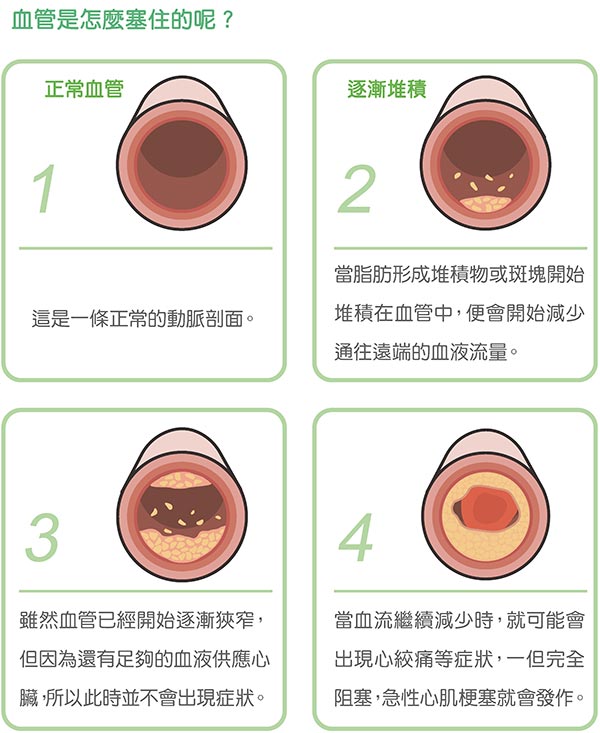 大腸癌的危險因子！