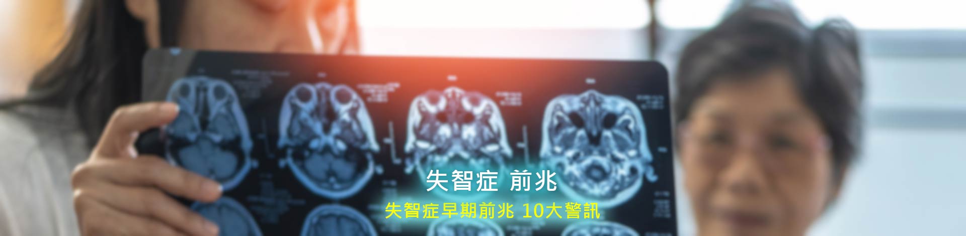 失智症症狀，失智症早期徵兆，10 大警訊