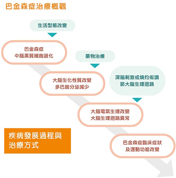 帕金森症治療概觀。