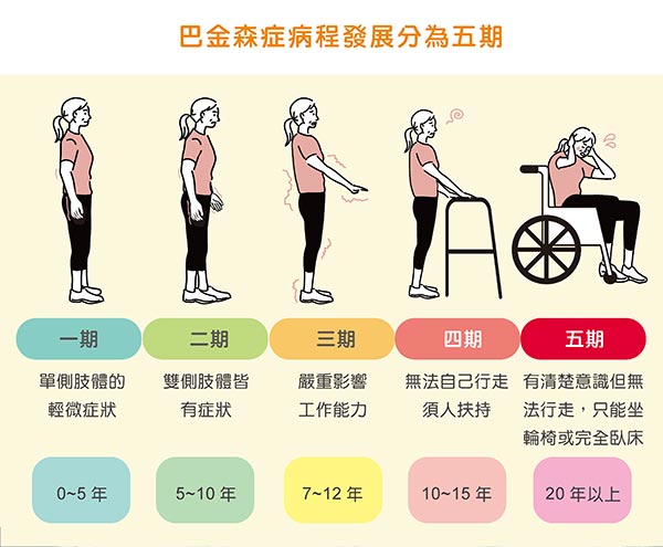 帕金森症病程發展分為五期。